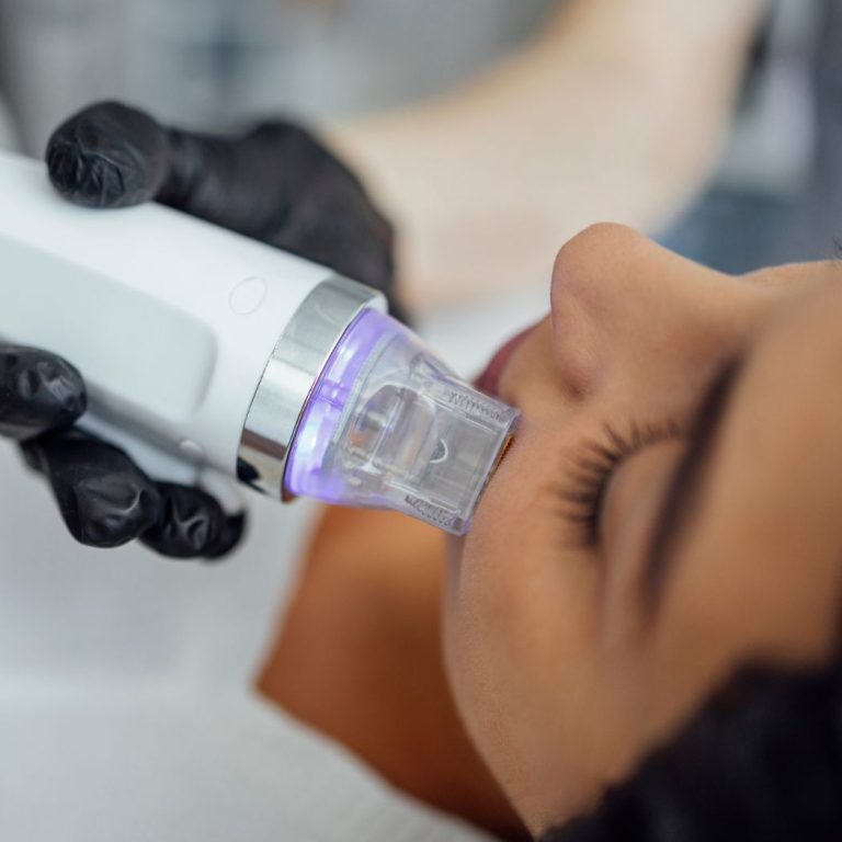 Imagen principal de la microaguja pico 808 (6)