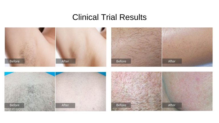 EXFU V1 ( EXFU ICELLO ) Schnittkarte (8)