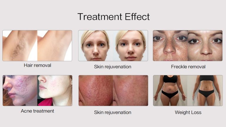 4in1-V17 Brochure_15